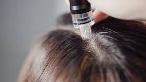Scalp revival