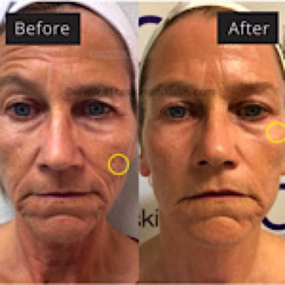 RITUAL REGENERATION SESSION at Ritual Beauty in Syracuse, NY