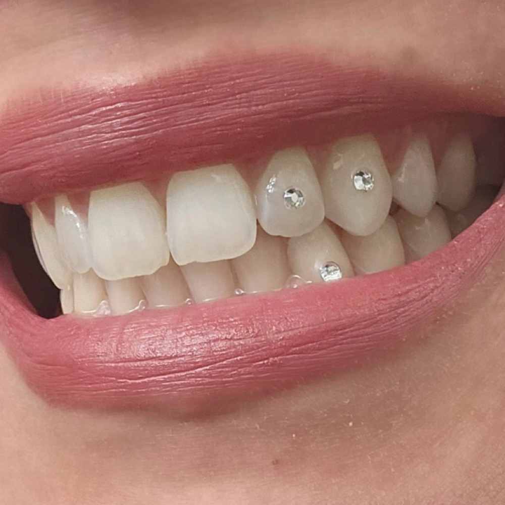 Havynn Smile Gems 💎 Custom Tooth at The Havynn For Beauty in Colorado Springs, CO