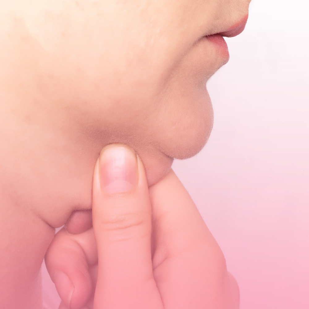 Chin Sculpting (FD)