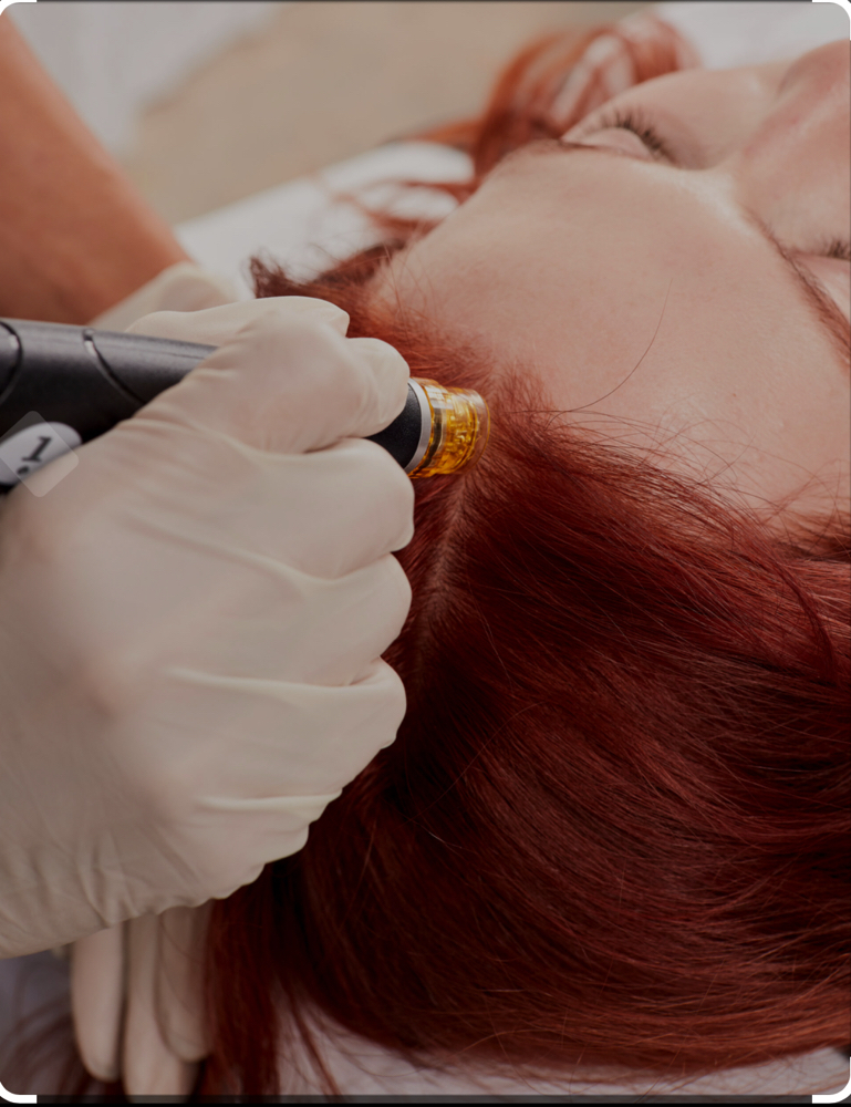 Hydroscalp Treatment