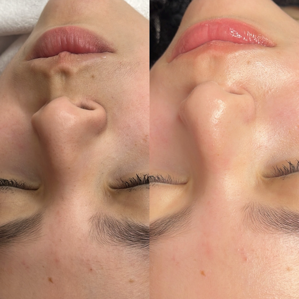 Teenager Facials at Divina Beauty Spa & Aesthetics in White Settlement, TX