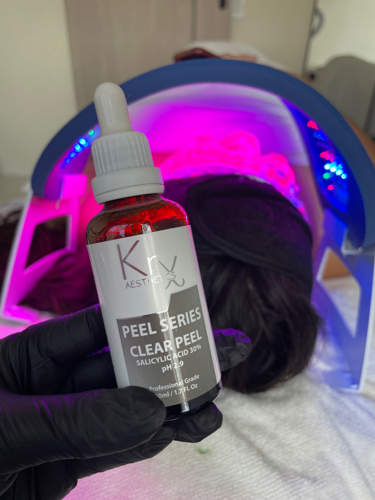 Acne Consultation + Treatment