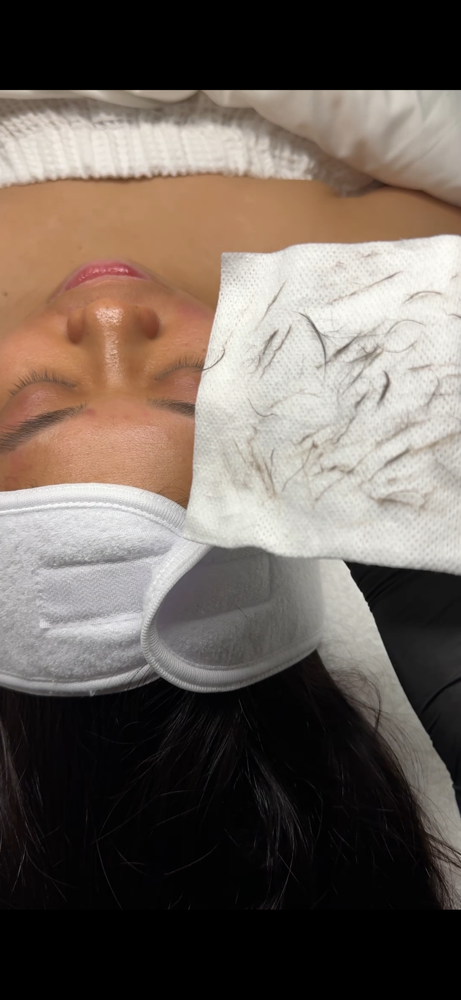 Dermaplaning Facial