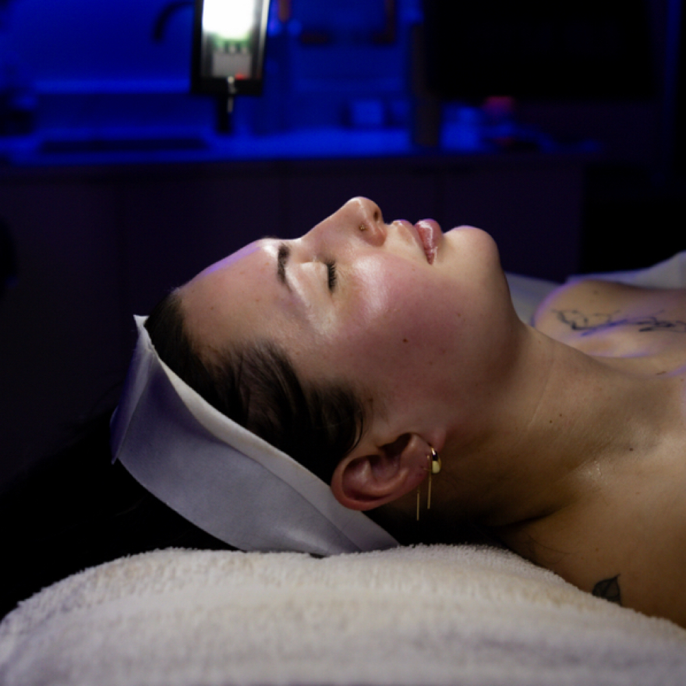 Alpha-Beta Acid Peel at Happy Skin Co. in Macomb, MI