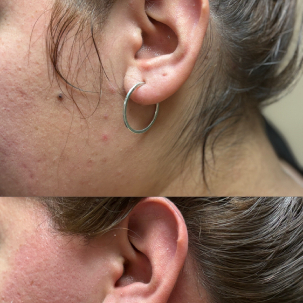 Sideburn Wax at Tesoro Luxe Aesthetics in San Antonio, TX