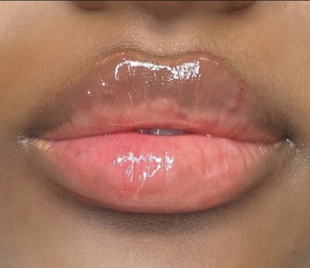 Lip Treatment