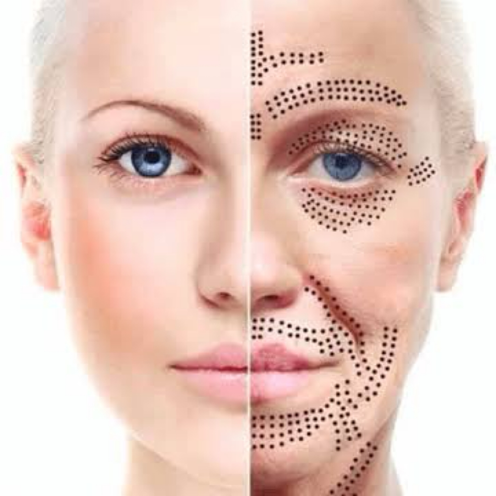 Plasma Pen at Allure Aesthetics & Wellness Studio in Midwest City, OK