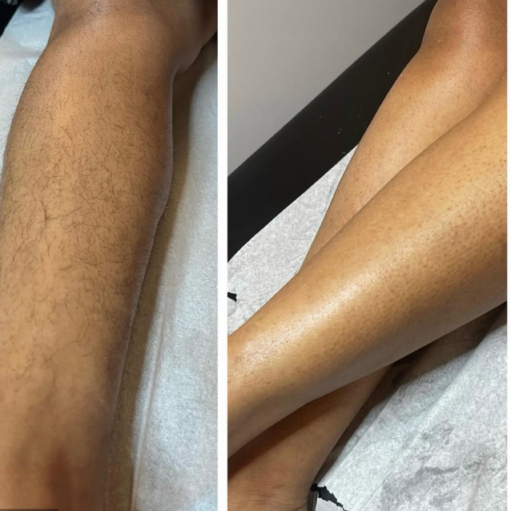 Full Leg and Arm Wax at Shawnee’s Spot in Severn, MD