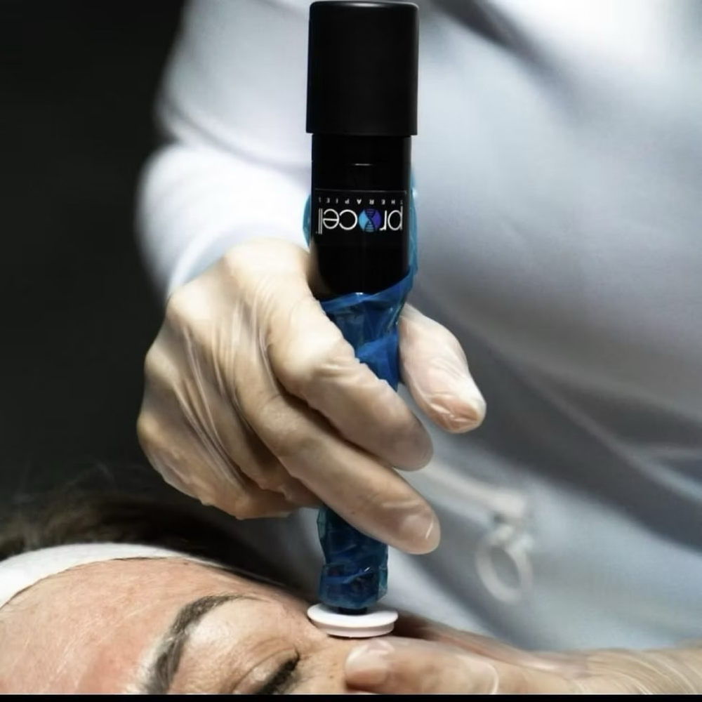 Procell Nano-needling at Lian Beauty Studio in Glendale, CO