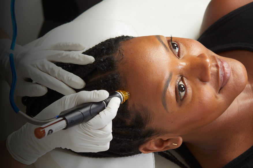 Keravive Scalp Treatment