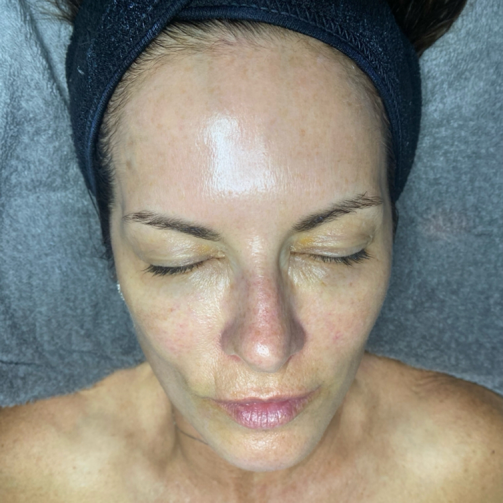 Sunset Renewal Anti-Aging Facial at Studio P in Lexington, KY