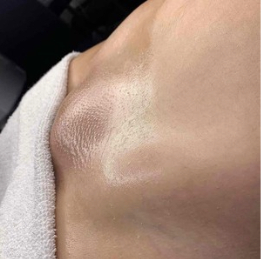 Brazilian Wax