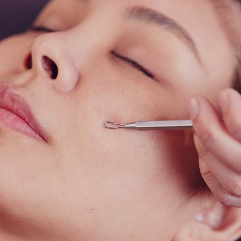 Extractions Add On Facial at A Touch By Mel in Ontario, CA