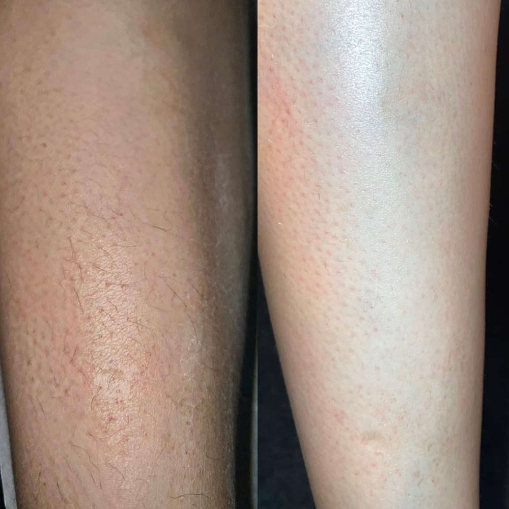 Full Leg Wax