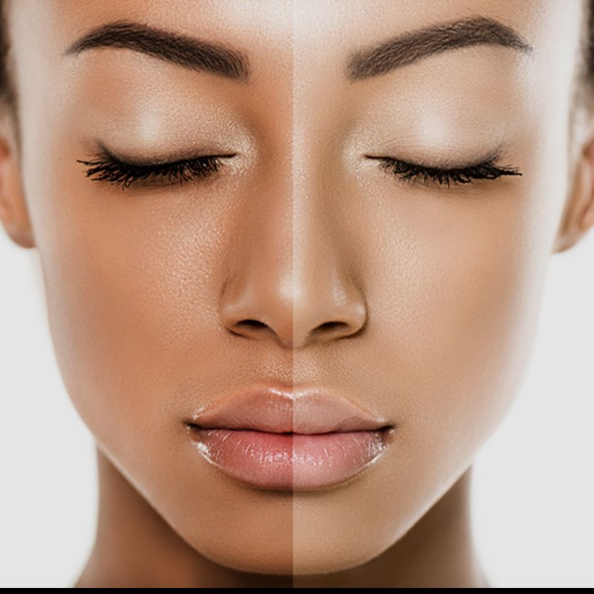 Glow Bright Whitening Therapy at The Glow & Care Spot in El Monte, CA