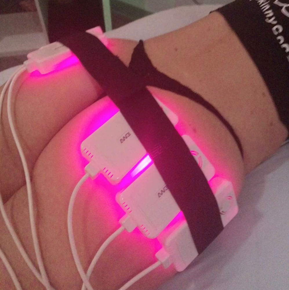 Lipo Laser Glutes at Des Beauty & Skin in El Paso, TX