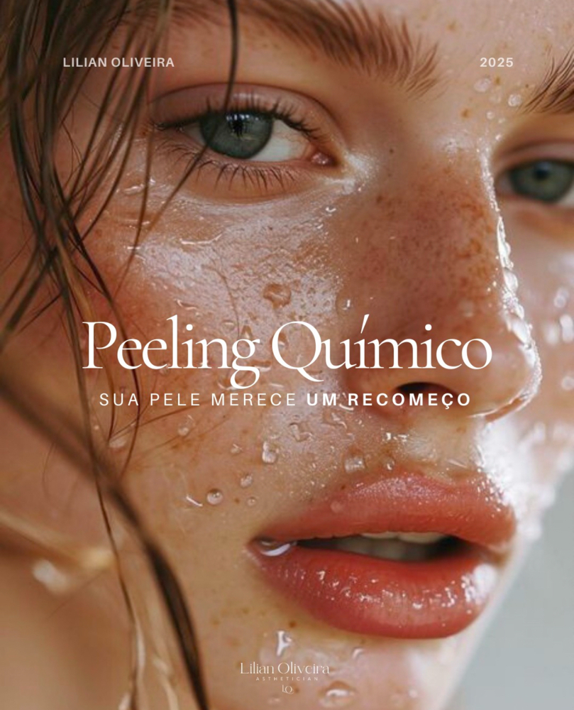 Peeling Chemical