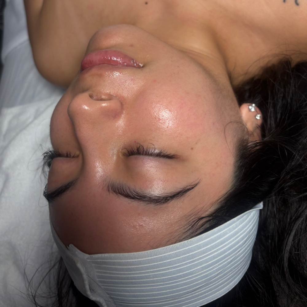 Bare Reset Facial at Ikonic Aesthetic Lounge in Asheboro, NC
