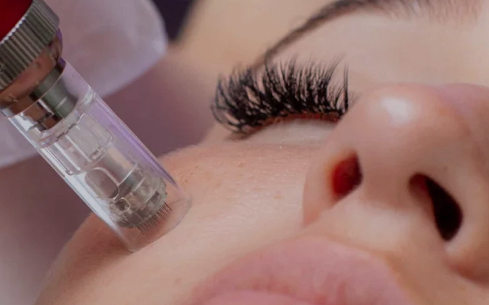 Microneedling & Dermaplaning