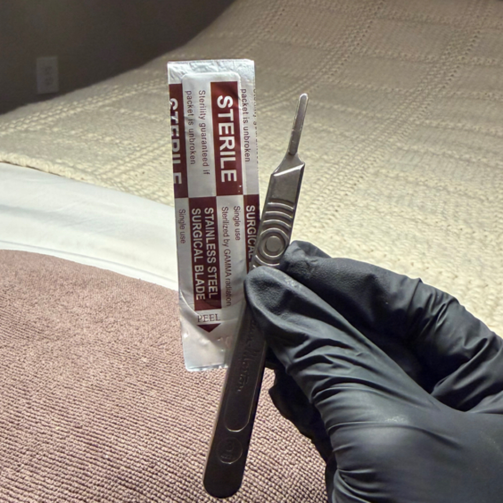 Dermaplane at The Dermal Clinic in Lodi, CA