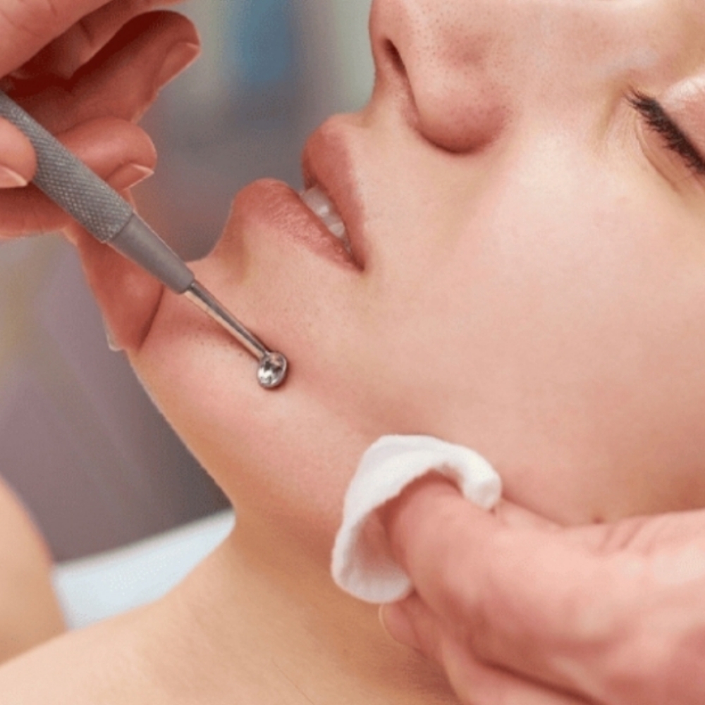 Extraction ( Add-on) at Cultivated Beauty by Cindy Bennett in Lewisburg, WV