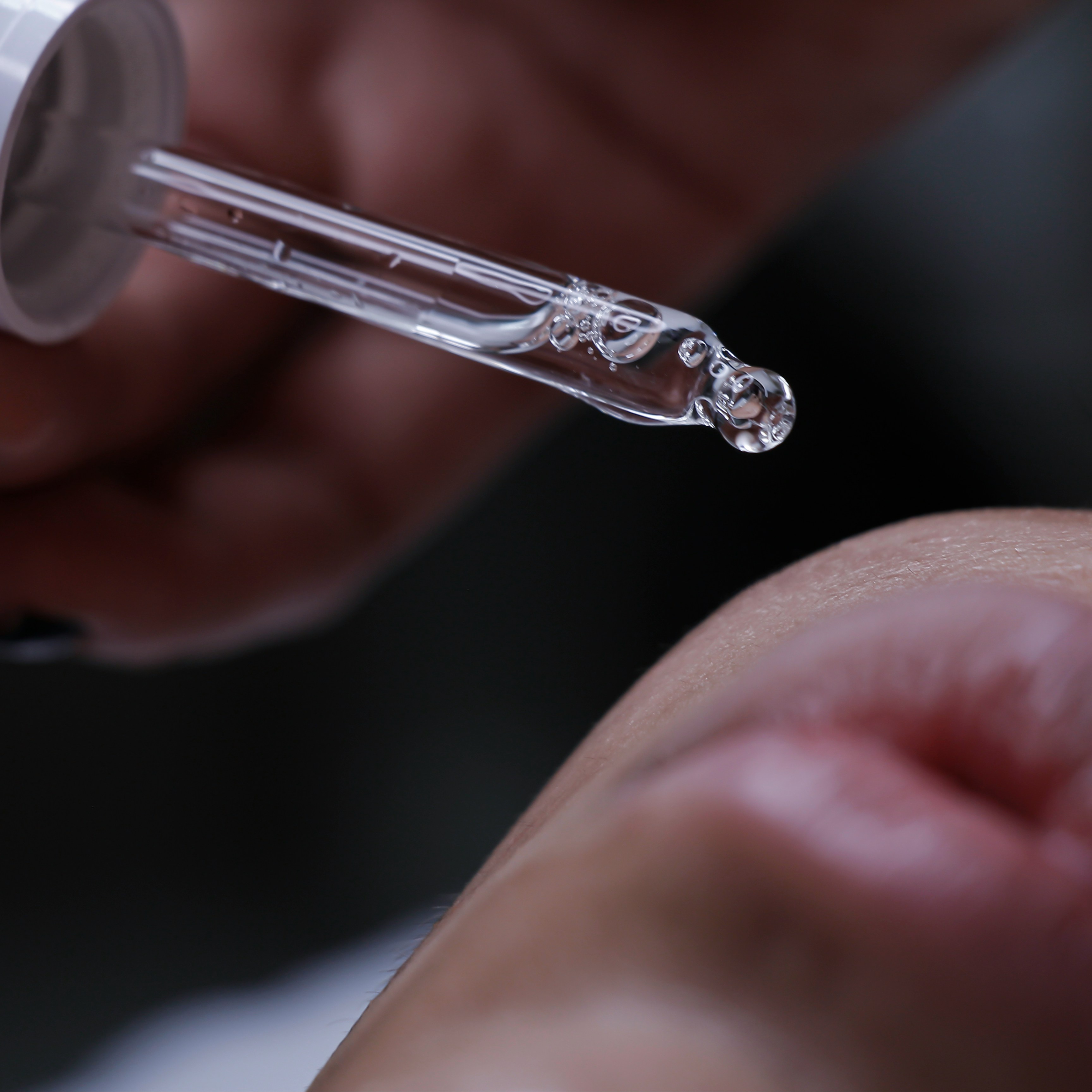 Chemical Peel at JHL Spa, LLC in Birmingham, AL