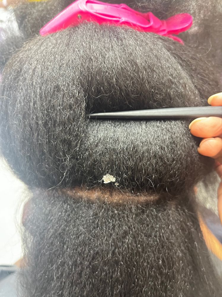 Dry, Flaky, Itchy Scalp Treatment