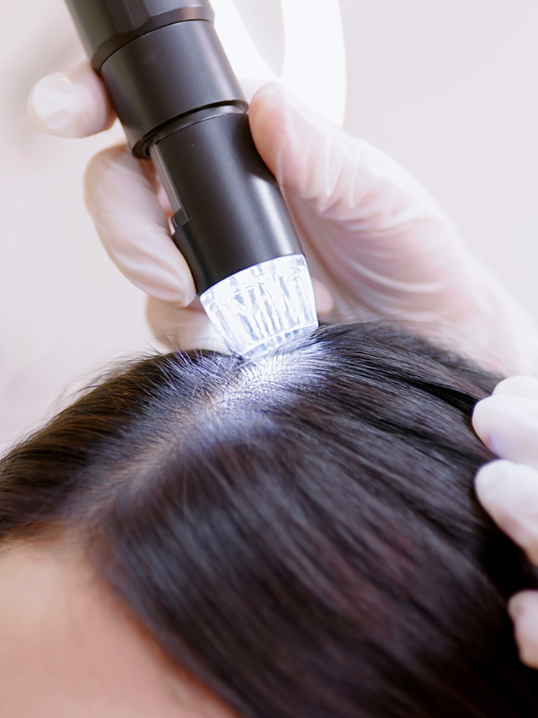 Scalp Treatments