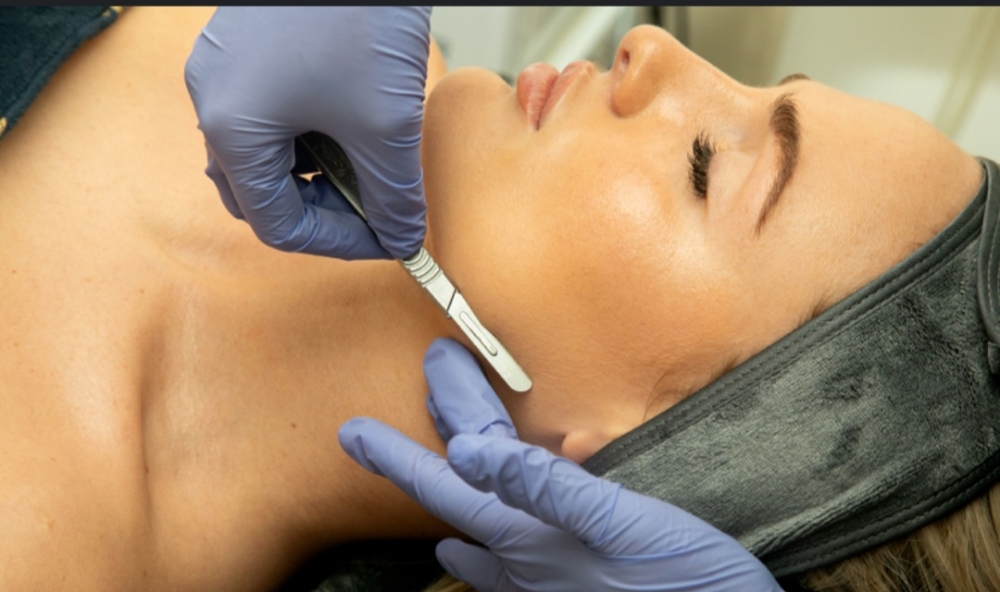 Dermaplaning