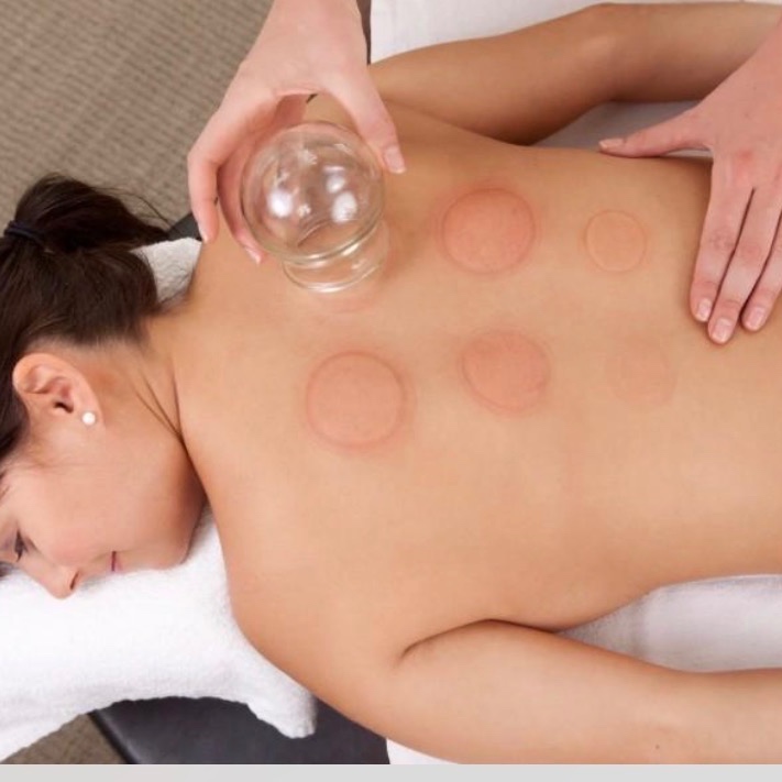 Cupping Add-on