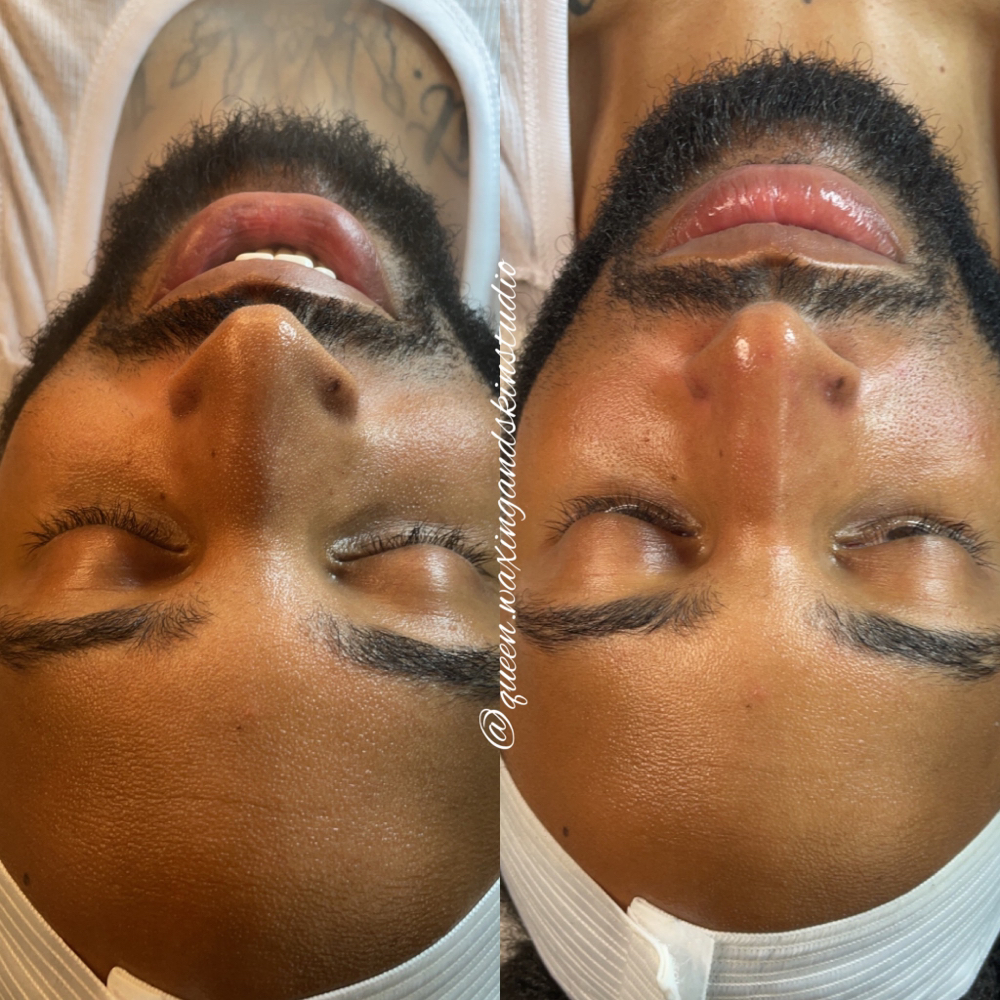 King Skin & Beard Treatment