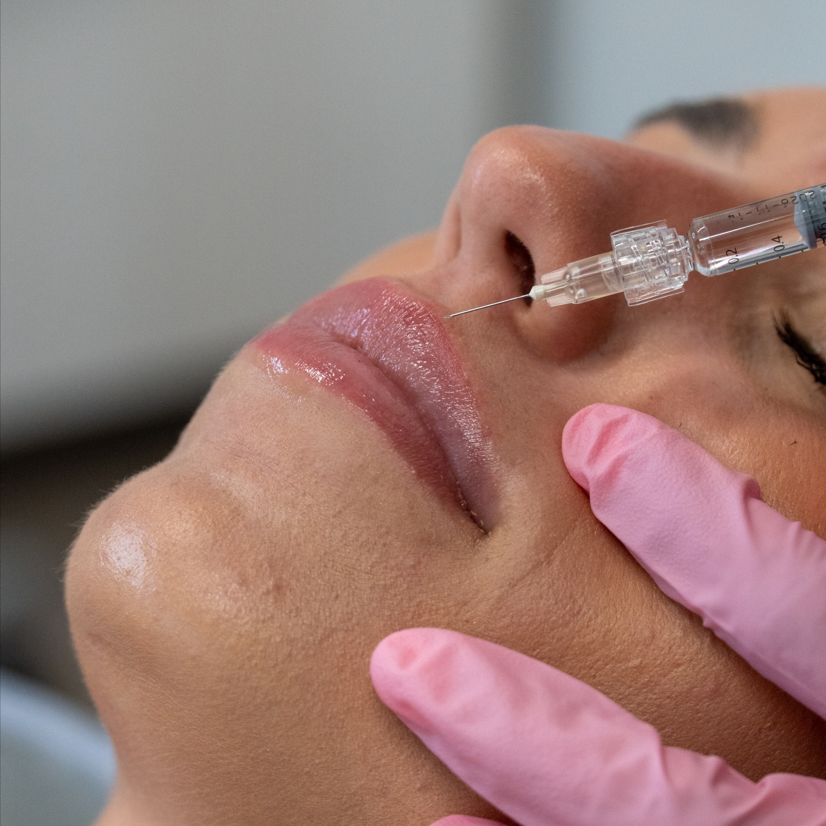 Signature Lips (Half a Syringe) at Luxe Level Aesthetics in Darien, CT