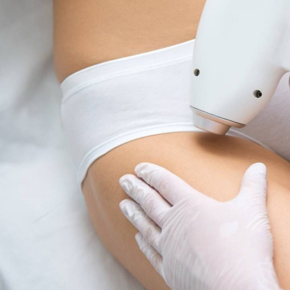 Laser Hair Removal • Bikini Line at Cox Clinic & Aesthetics in Antlers, OK