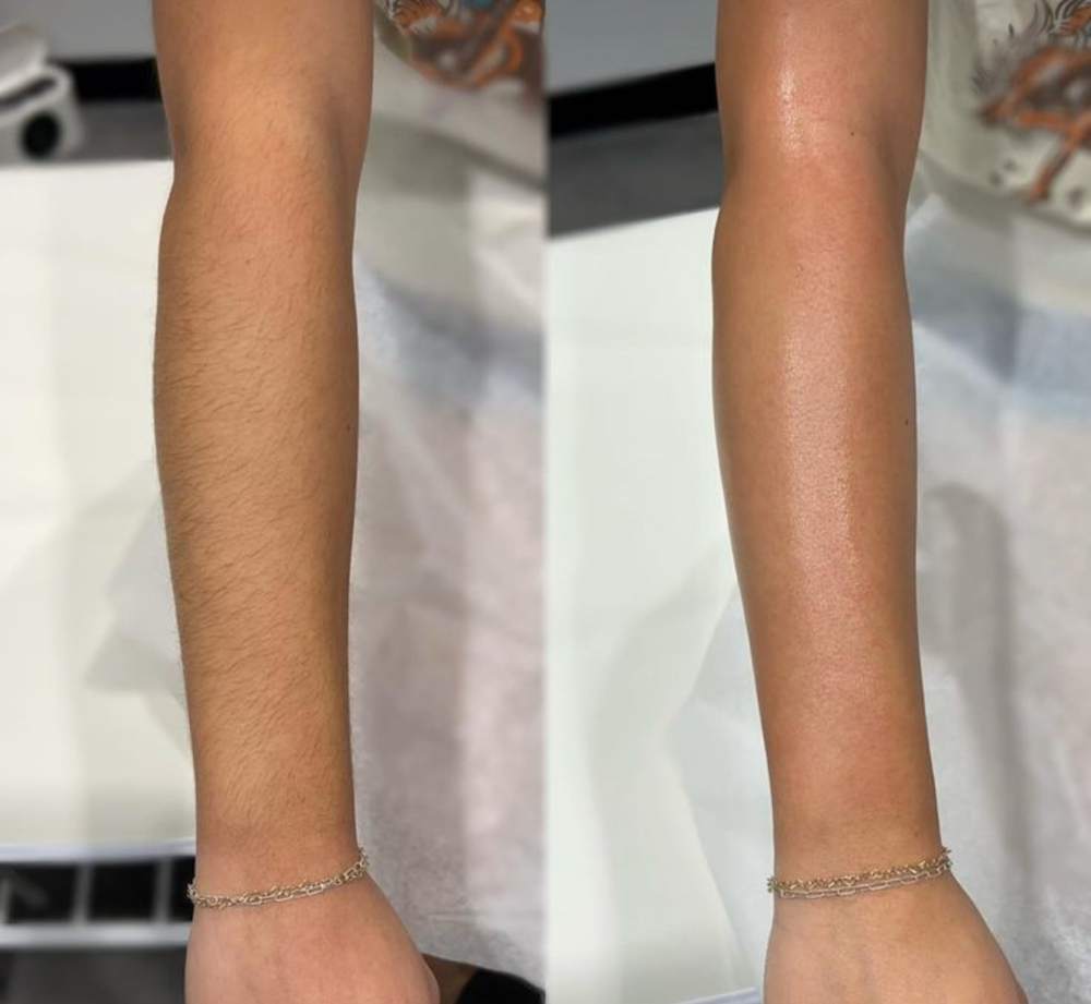 Arm Wax