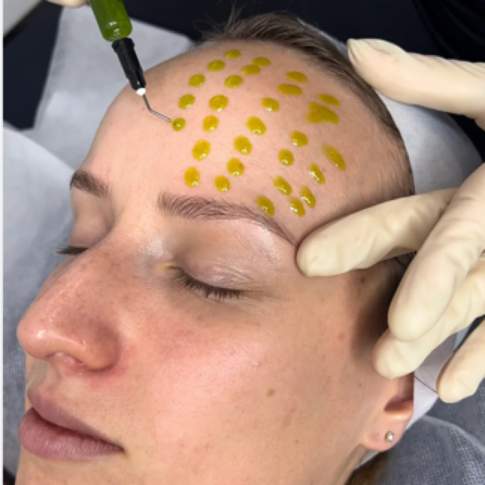 BioRePeel at Beauty And Body in San Dimas, CA