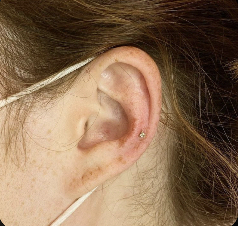 Mid Helix (each)