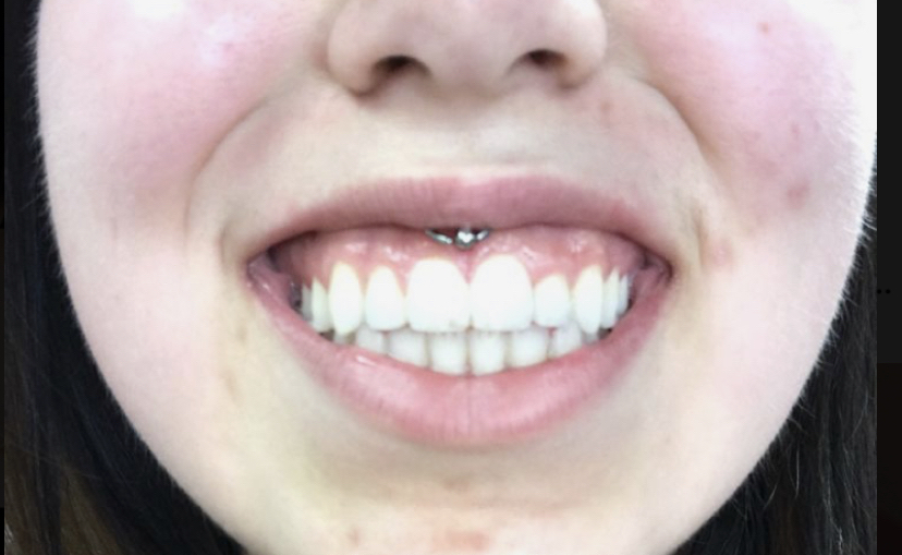 Smiley
