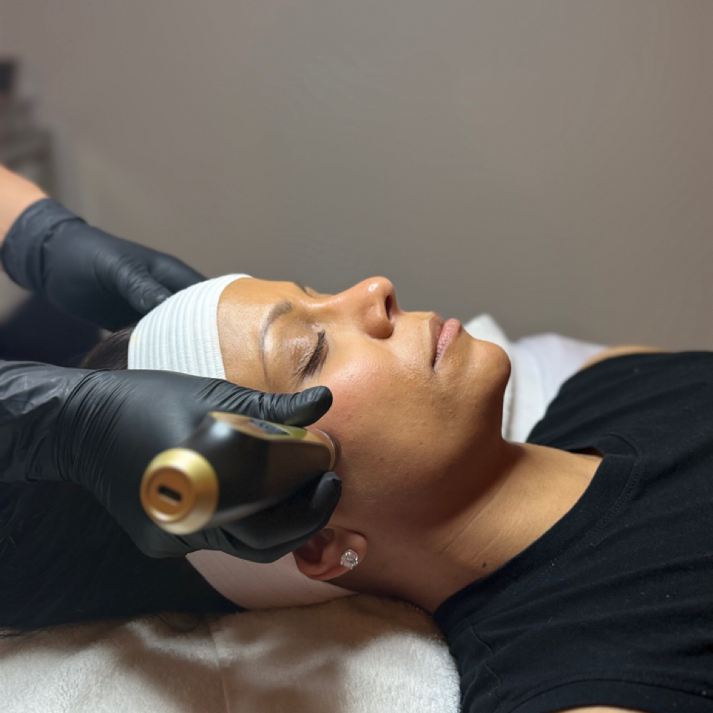Collagen Induction Therapy 4pk at Tillie's Skincare Studio in Rockland, MA
