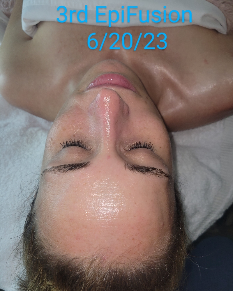 Vitamin C Brightening Facial