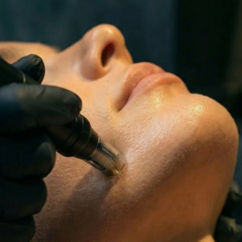 Nano Needling + Soothing Mask at Bare + Bronzed in Fort Worth, TX
