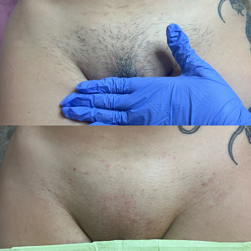 Brazillian Wax