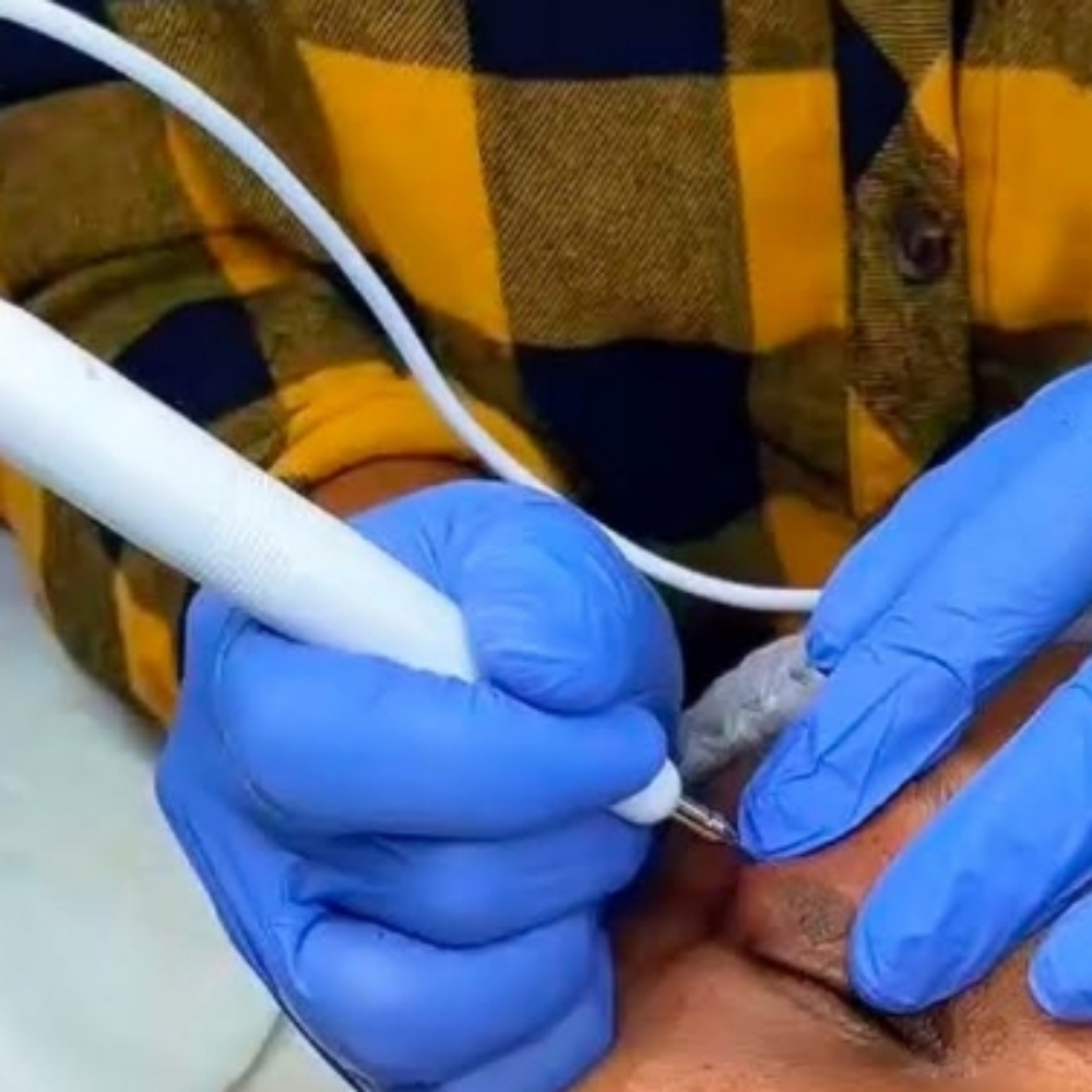 Skintag MACHINE at LOOKATHER SKINBODY&LASHES AESTHETICS in Roswell, GA