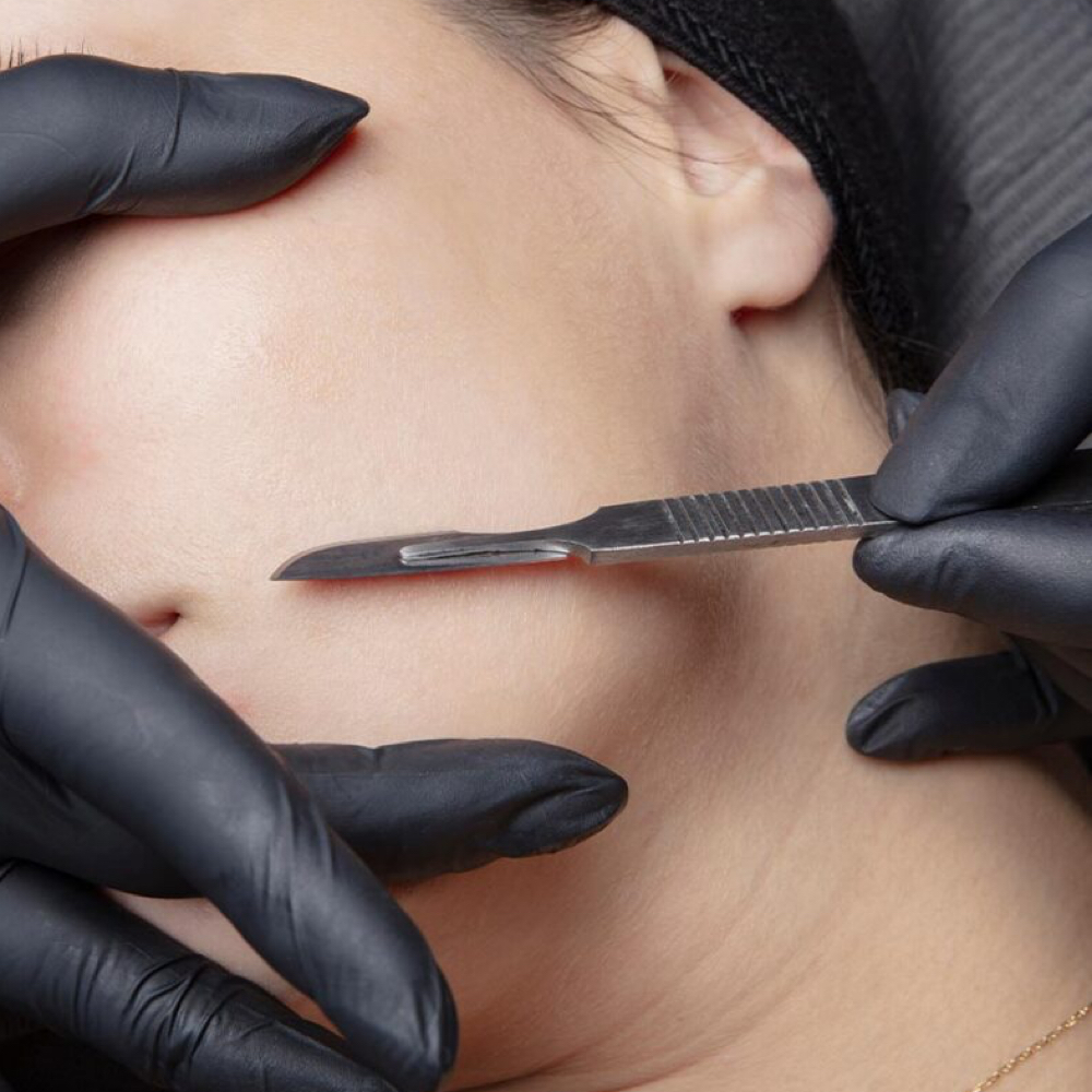 Dermaplane Add On at Victoria Skin Lifting in Matawan, NJ