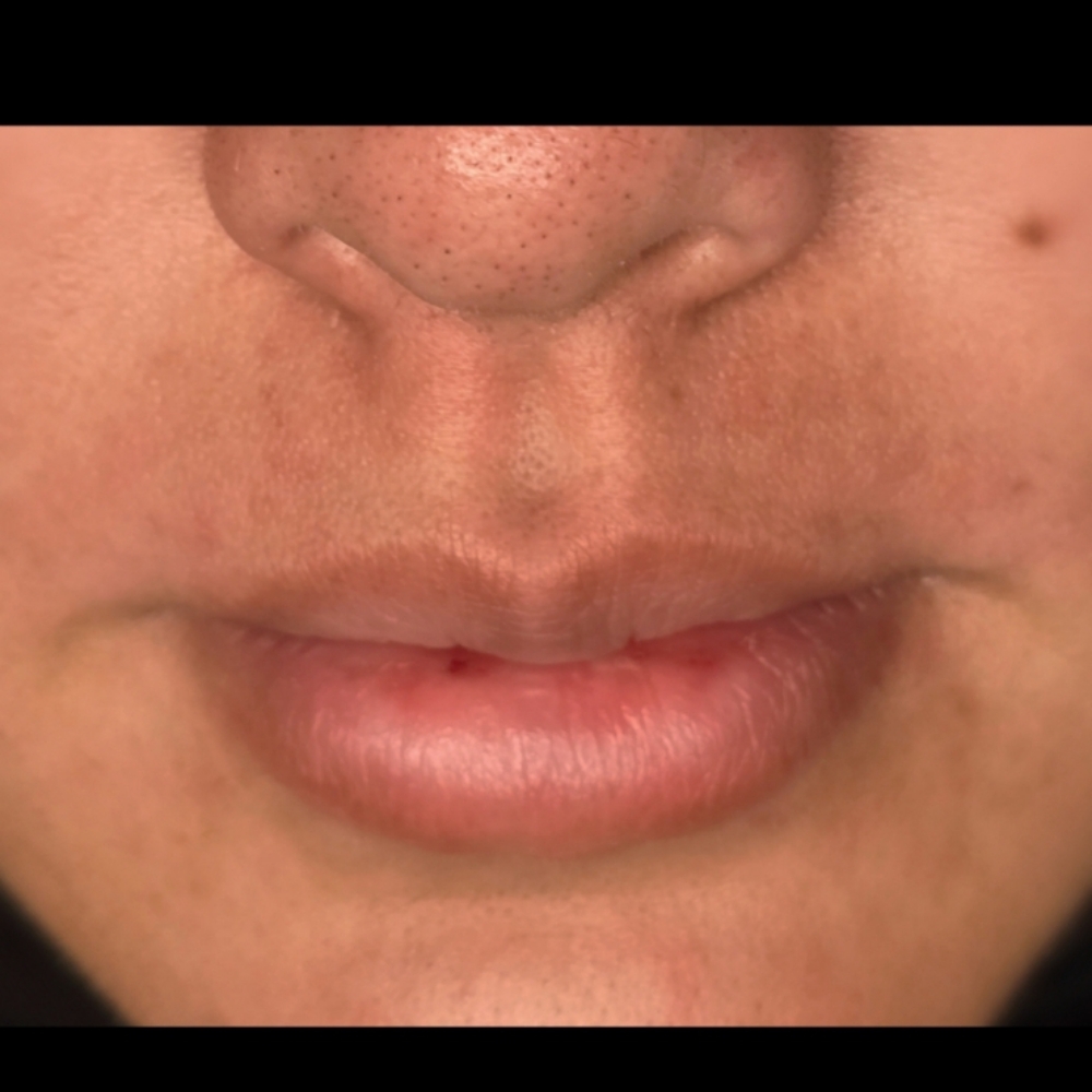 Lip Thread at Krystal Eyes in Overland Park, KS