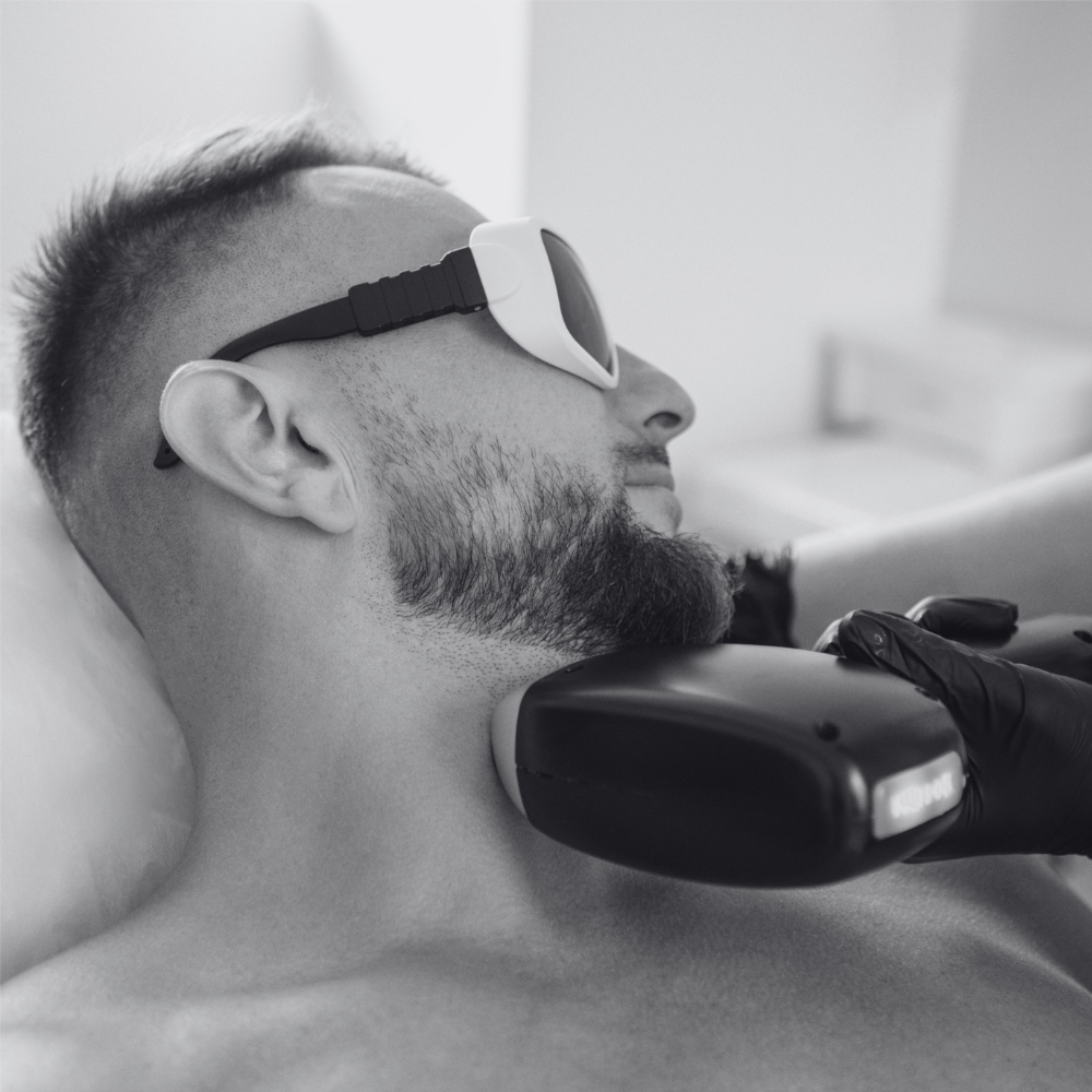 Laser Hair Removal - Side Burns at Kietre Wellness & Aesthetics in North Las Vegas, NV