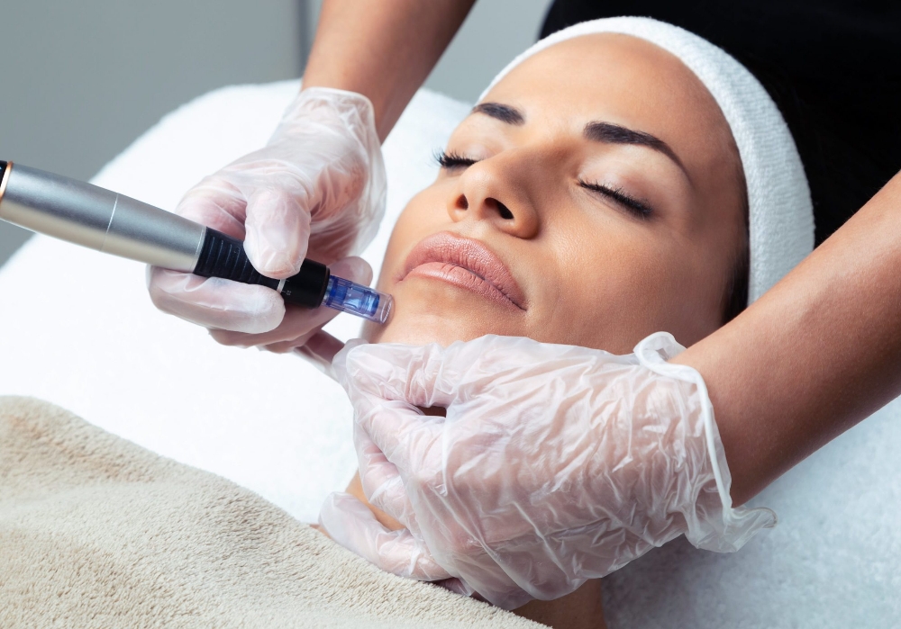 Microneedling With LED therapy