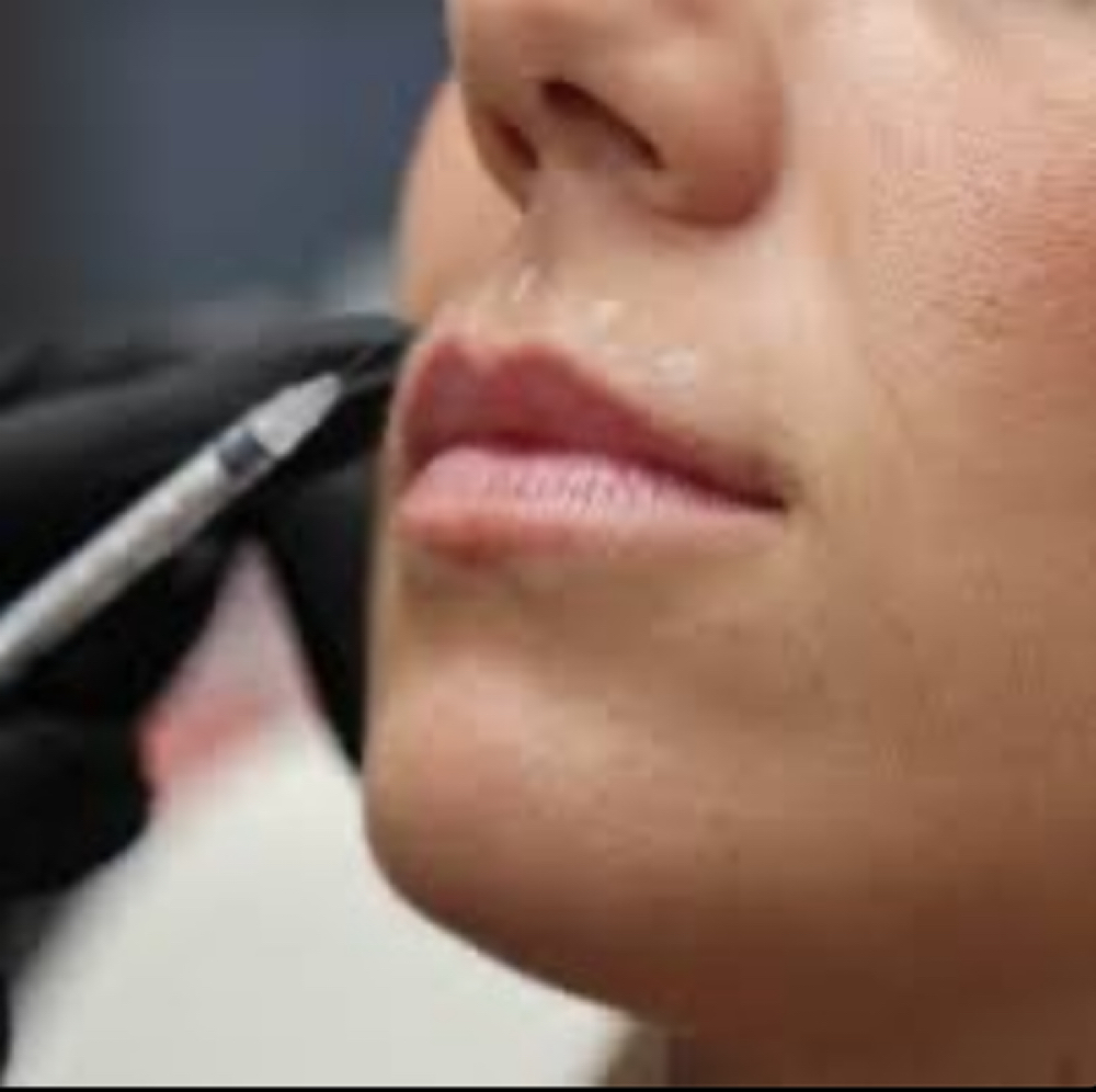Lip Flip at Roots Aesthetic & Wellness LLC in McAllen, TX