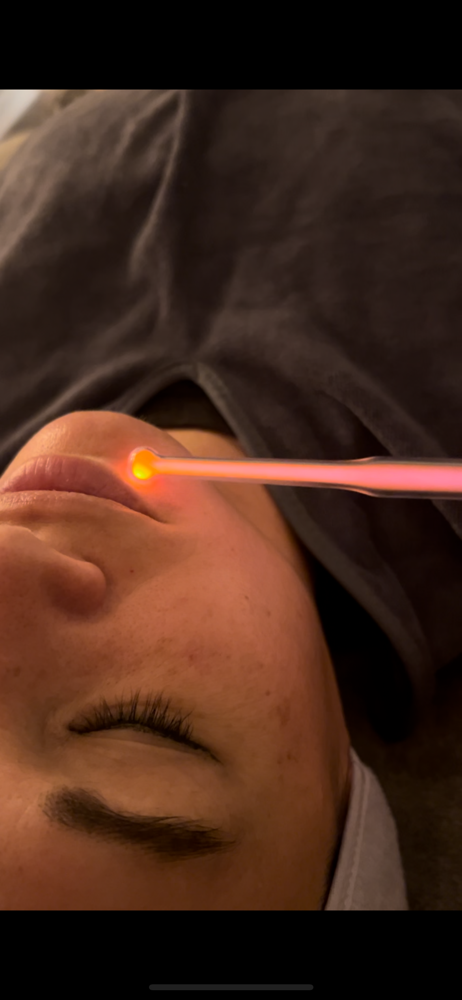High Frequency Signature Facial