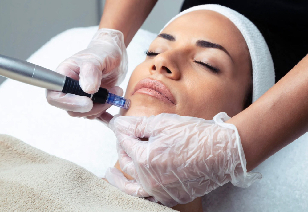 Nanoneedling Treatment at Jewels Beauty in Fairview, NJ